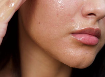 How to Get Rid of Oily Skin?